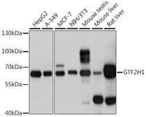 Anti-GTF2H1 antibody used in Western Blot (WB). GTX66483