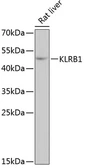 Anti-CD161 antibody used in Western Blot (WB). GTX66487