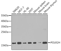 Anti-RPB8 antibody used in Western Blot (WB). GTX66488