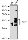 Anti-GluT1 antibody used in Western Blot (WB). GTX66489
