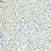 Anti-SOD3 antibody used in IHC (Paraffin sections) (IHC-P). GTX66490