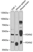 Anti-FOXN2 antibody used in Western Blot (WB). GTX66492