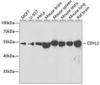 Anti-CDYL2 antibody used in Western Blot (WB). GTX66493