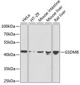 Anti-Gasdermin B antibody used in Western Blot (WB). GTX66495
