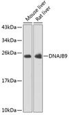 Anti-DNAJB9 antibody used in Western Blot (WB). GTX66496