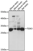 Anti-STK22C antibody used in Western Blot (WB). GTX66499