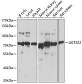 Anti-UGT3A2 antibody used in Western Blot (WB). GTX66500