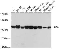 Anti-LYAG antibody used in Western Blot (WB). GTX66501