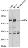 Anti-ORC4L antibody used in Western Blot (WB). GTX66502