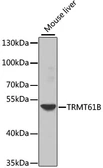 Anti-TRMT61B antibody used in Western Blot (WB). GTX66508