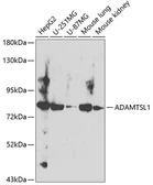 Anti-ADAMTSL1 antibody used in Western Blot (WB). GTX66509
