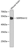 Anti-SERPINA12 antibody used in Western Blot (WB). GTX66510