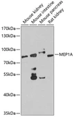 Anti-Meprin alpha antibody used in Western Blot (WB). GTX66511