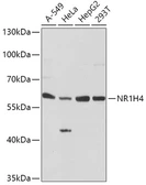 Anti-NR1H4 antibody used in Western Blot (WB). GTX66515