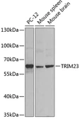 Anti-TRIM23 antibody used in Western Blot (WB). GTX66516