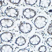 Anti-SMRT antibody used in IHC (Paraffin sections) (IHC-P). GTX66517