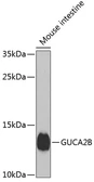 Anti-GUCA2B antibody used in Western Blot (WB). GTX66518