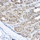 Anti-GNB2 antibody used in IHC (Paraffin sections) (IHC-P). GTX66519