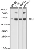 Anti-HIP antibody used in Western Blot (WB). GTX66521