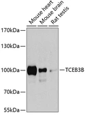 Anti-ELOA2 antibody used in Western Blot (WB). GTX66526