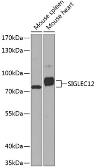 Anti-SIGLEC12 antibody used in Western Blot (WB). GTX66530