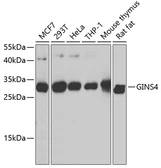 Anti-SLD5 antibody used in Western Blot (WB). GTX66532