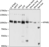 Anti-Importin beta 1 antibody used in Western Blot (WB). GTX66534
