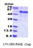 Human MAK16 protein, His tag. GTX66535-pro