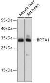 Anti-PLUNC antibody used in Western Blot (WB). GTX66536
