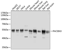 Anti-PACSIN3 antibody used in Western Blot (WB). GTX66537