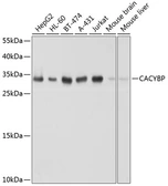 Anti-CacyBP antibody used in Western Blot (WB). GTX66541