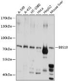 Anti-BBS10 antibody used in Western Blot (WB). GTX66542