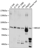 Anti-BBS10 antibody used in Western Blot (WB). GTX66542