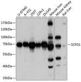 Anti-SCFD1 antibody used in Western Blot (WB). GTX66543