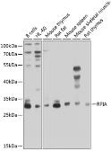 Anti-RPIA antibody used in Western Blot (WB). GTX66545