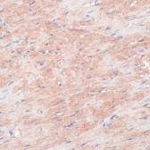 Anti-RPIA antibody used in IHC (Paraffin sections) (IHC-P). GTX66545