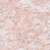Anti-RPIA antibody used in IHC (Paraffin sections) (IHC-P). GTX66545
