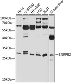 Anti-SNRPB2 antibody used in Western Blot (WB). GTX66547