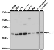Anti-SUCLG2 antibody used in Western Blot (WB). GTX66548