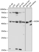 Anti-GCDH antibody used in Western Blot (WB). GTX66552