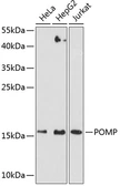 Anti-POMP antibody used in Western Blot (WB). GTX66553