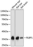 Anti-CRALBP antibody used in Western Blot (WB). GTX66554