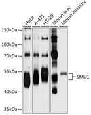 Anti-SMU1 antibody used in Western Blot (WB). GTX66555