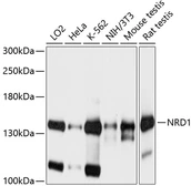 Anti-Nardilysin antibody used in Western Blot (WB). GTX66556