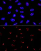 Anti-EBNA1BP2 antibody used in Immunocytochemistry/ Immunofluorescence (ICC/IF). GTX66557