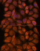 Anti-SNX15 antibody used in Immunocytochemistry/ Immunofluorescence (ICC/IF). GTX66558