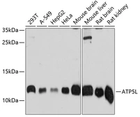 Anti-ATP5L antibody used in Western Blot (WB). GTX66560