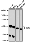 Anti-IST1 antibody used in Western Blot (WB). GTX66565