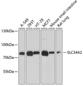 Anti-SLC34A2 antibody used in Western Blot (WB). GTX66568