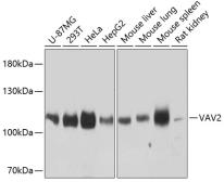 Anti-VAV2 antibody used in Western Blot (WB). GTX66569